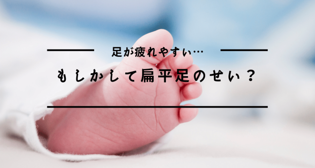 足が疲れやすい もしかして扁平足のせい 楽歩堂 E Shop Note