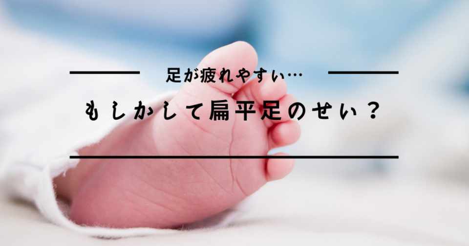 足が疲れやすい もしかして扁平足のせい 楽歩堂 E Shop Note