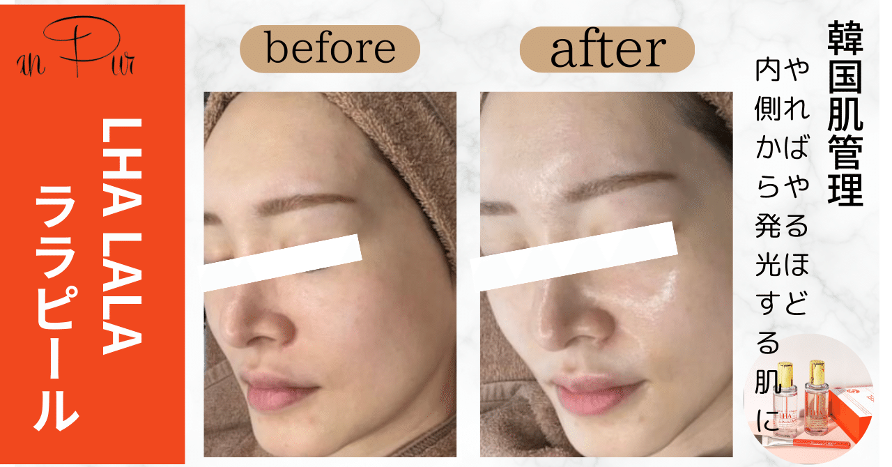 LHA LALAララピール3回分 LHALALA PEEL(ララピール)｜公式代理店｜株式会社シンビシン