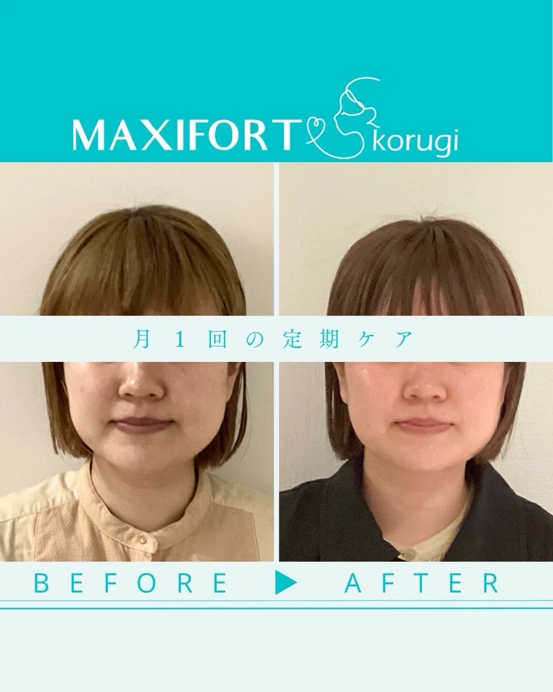 お顔の施術事例 小顔コルギ☆途中経過をご紹介|小顔コルギ専門店マキシフォート<MAXIFORT>