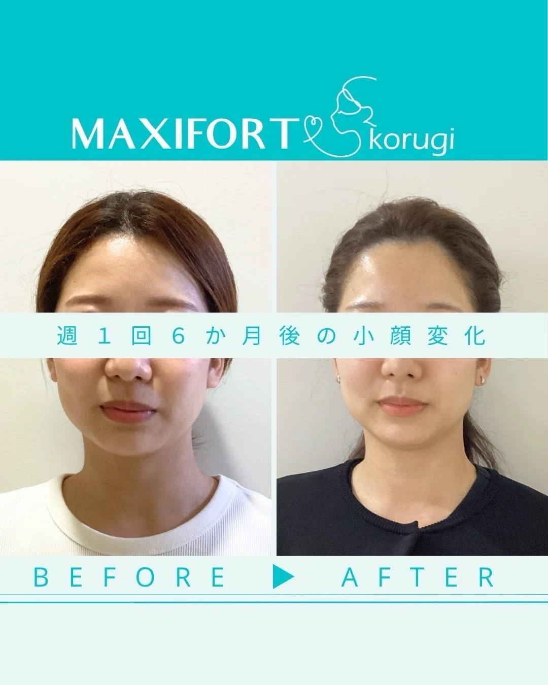 【お顔の施術事例】小顔コルギ☆途中経過をご紹介|小顔コルギ専門店マキシフォート<MAXIFORT>