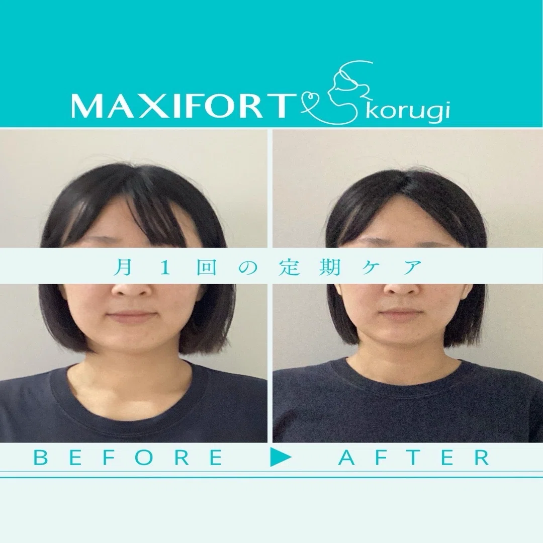 【6ヶ月で】ツヤ肌小顔へ | 名古屋小顔サロン｜マイナス5キロ顔屋さん〈MAXIFORT〉