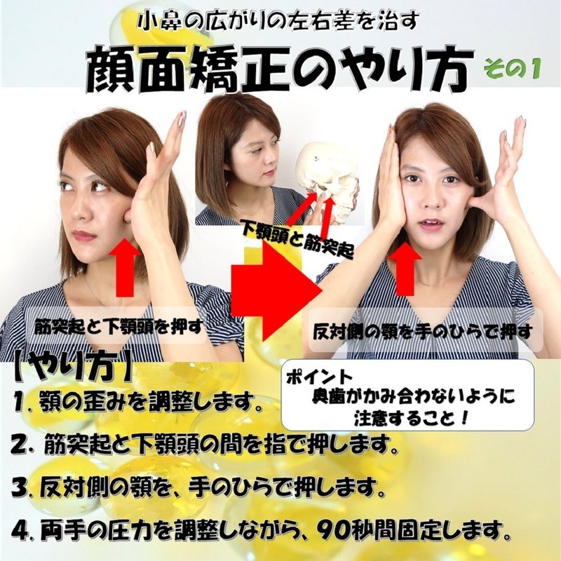 小鼻の広がりの左右差を治す顔面矯正のやり方 その１ Revisionginza Note