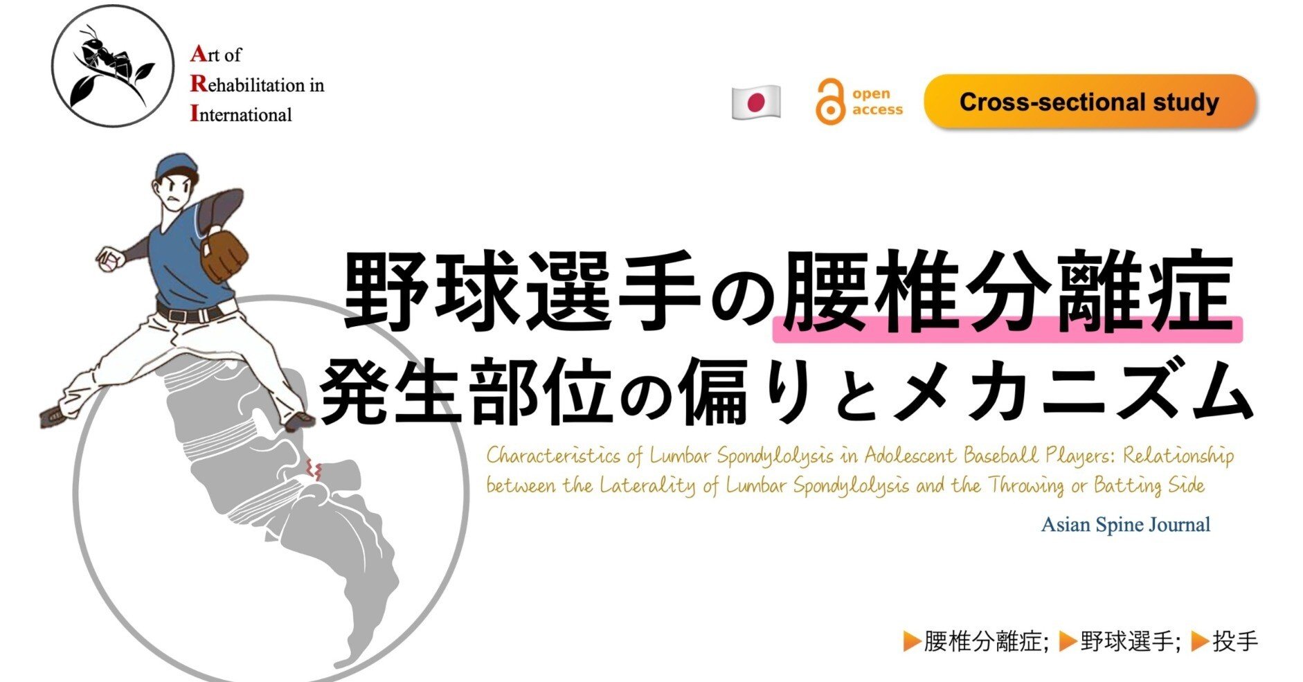 スポーツと腰痛: メカニズム＆マネジメント スポ－ツと腰痛メカニズム＆マネジメント / 山下敏彦 - 紀伊國屋