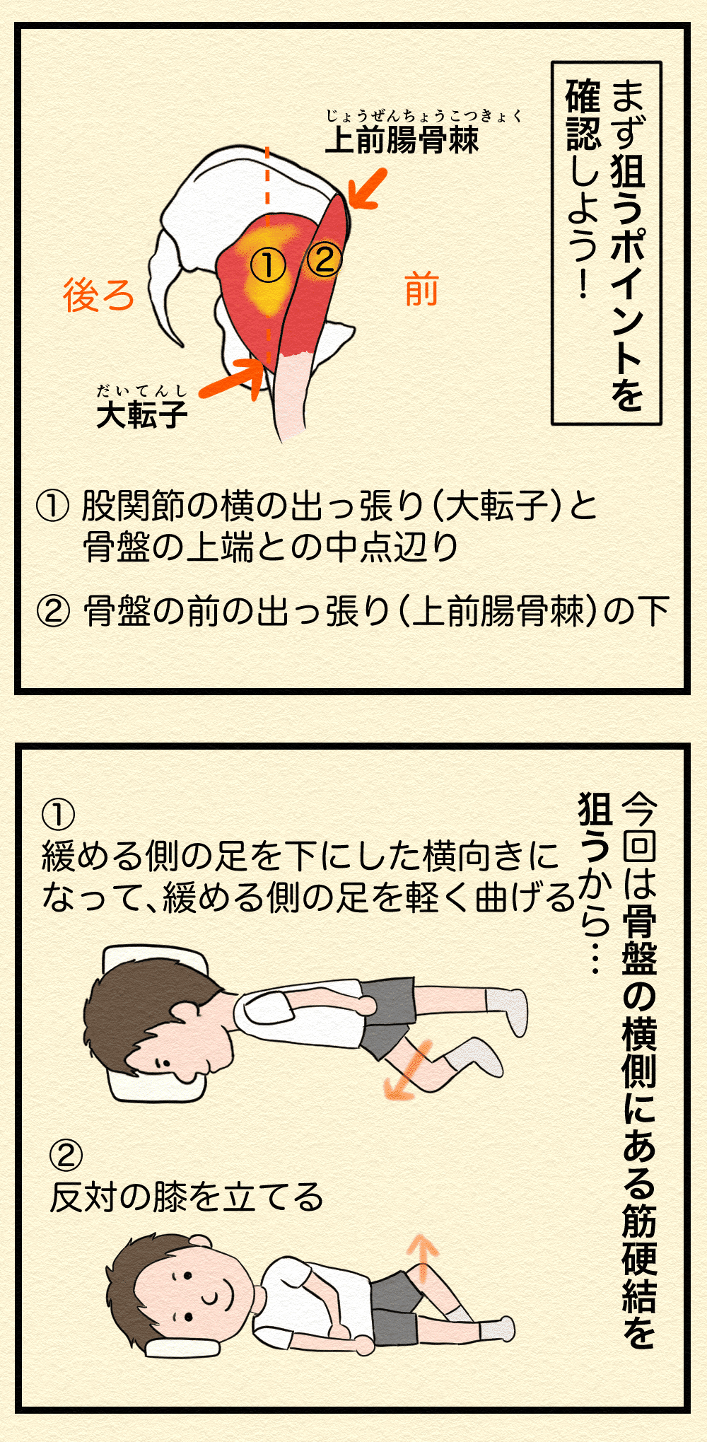 整体マンガ16 坐骨神経痛様の痛みを起こす筋肉を緩める 癒しクリエイターズ Note