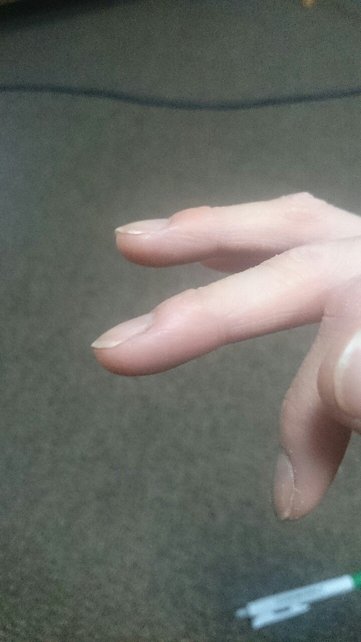 ペンだこの位置は Rock Paintingart 浜昼顔 Note