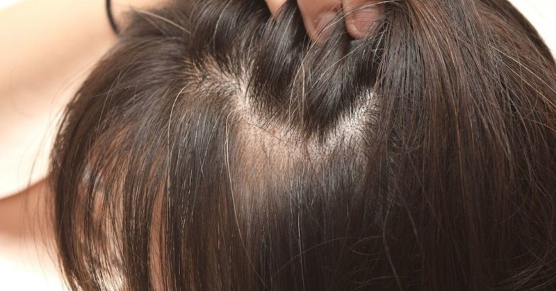 白髪染めによってアレルギー反応が出ないための対処法 みんみん Note