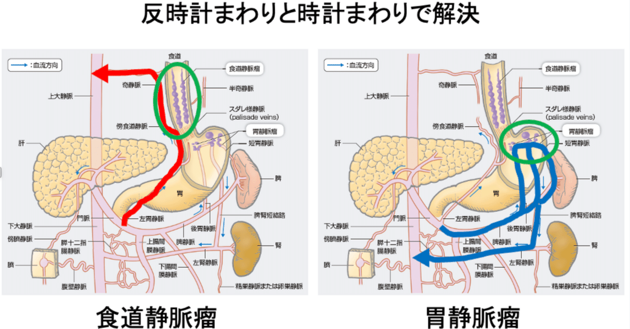 食道・胃静脈瘤 | 小原勝敏, 鈴木博昭, 村島直哉, 國分茂博