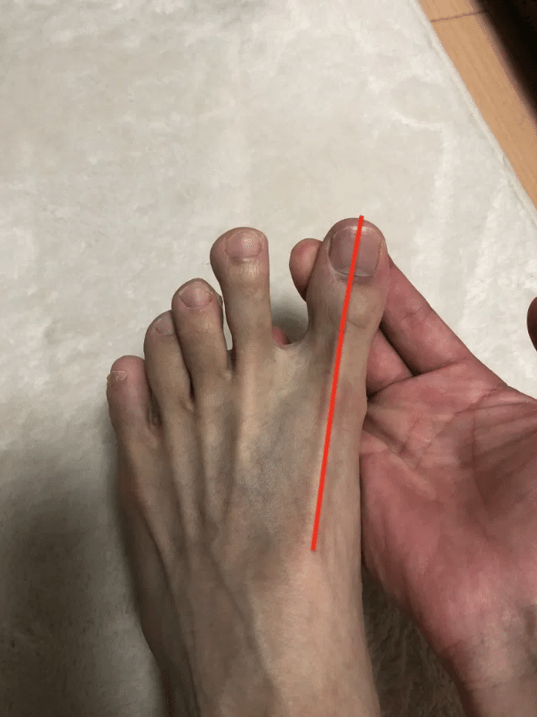 健康に良いor悪い 5本指ソックスの効果について本気で調査してみた N 訪看事業所の所長 二子玉川 Note 健康に良いor悪い 5本指ソックスの効果について本気で調査してみた N 訪看事業所の所長 二子玉川 Note