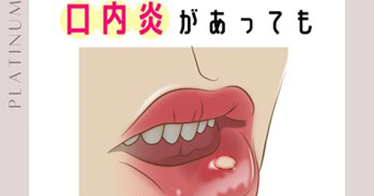 口内炎があってもホワイトニングできる？☆口コミ好評！南柏で人気の 