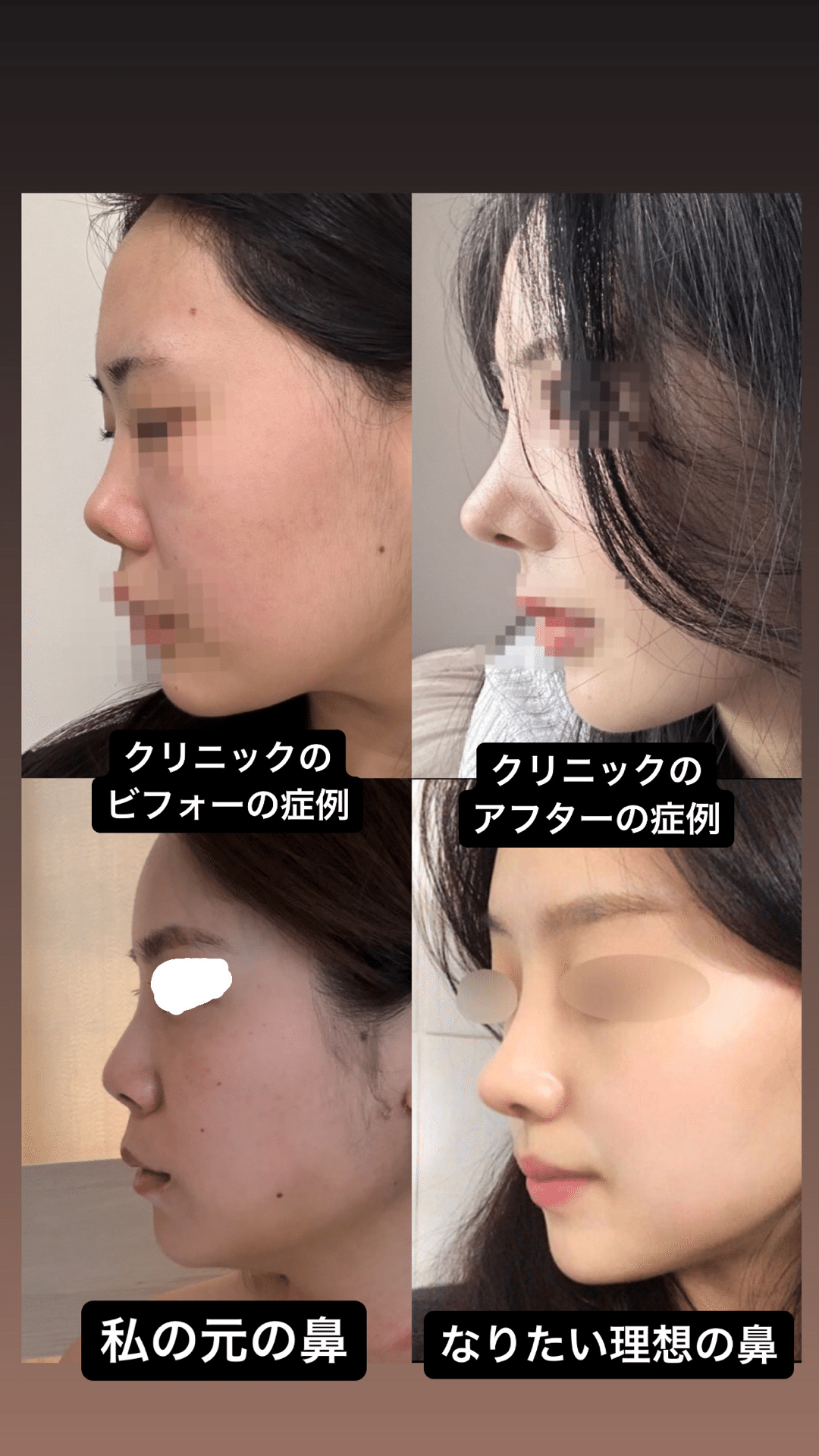 二重整形をしてすぐにメイクはできるの？ | 湘南美容クリニック, image size:1080x1920