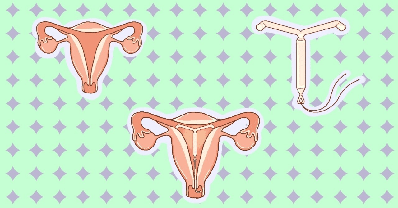 キリナとは何ですか?