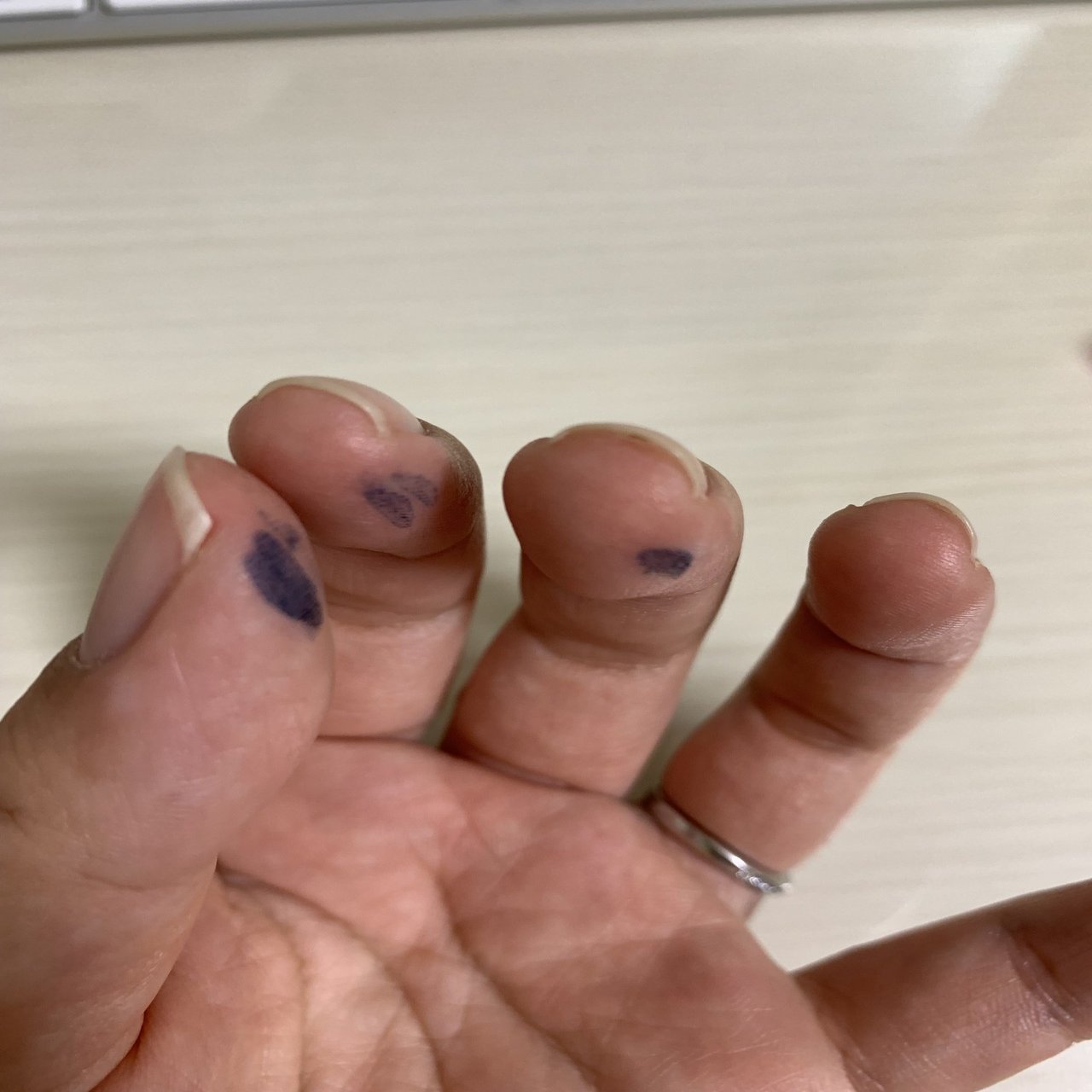 万年筆インク充填で手が汚れる問題 からふる Note