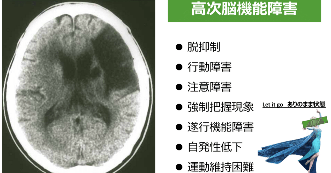 頭部外傷｜ネクストリハアカデミー