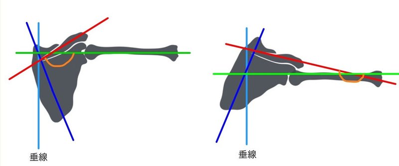 スピノ ヒューメラルアングル Sha とは たくみロドリゲス 運動器理学療法士 Note スピノ ヒューメラルアングル Sha とは たくみロドリゲス 運動器理学療法士 Note