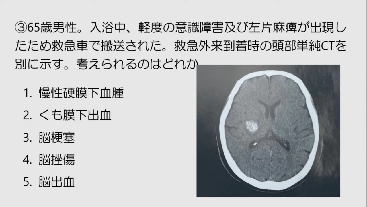 第59回理学療法士国家試験AM3問目｜ネクストリハアカデミー