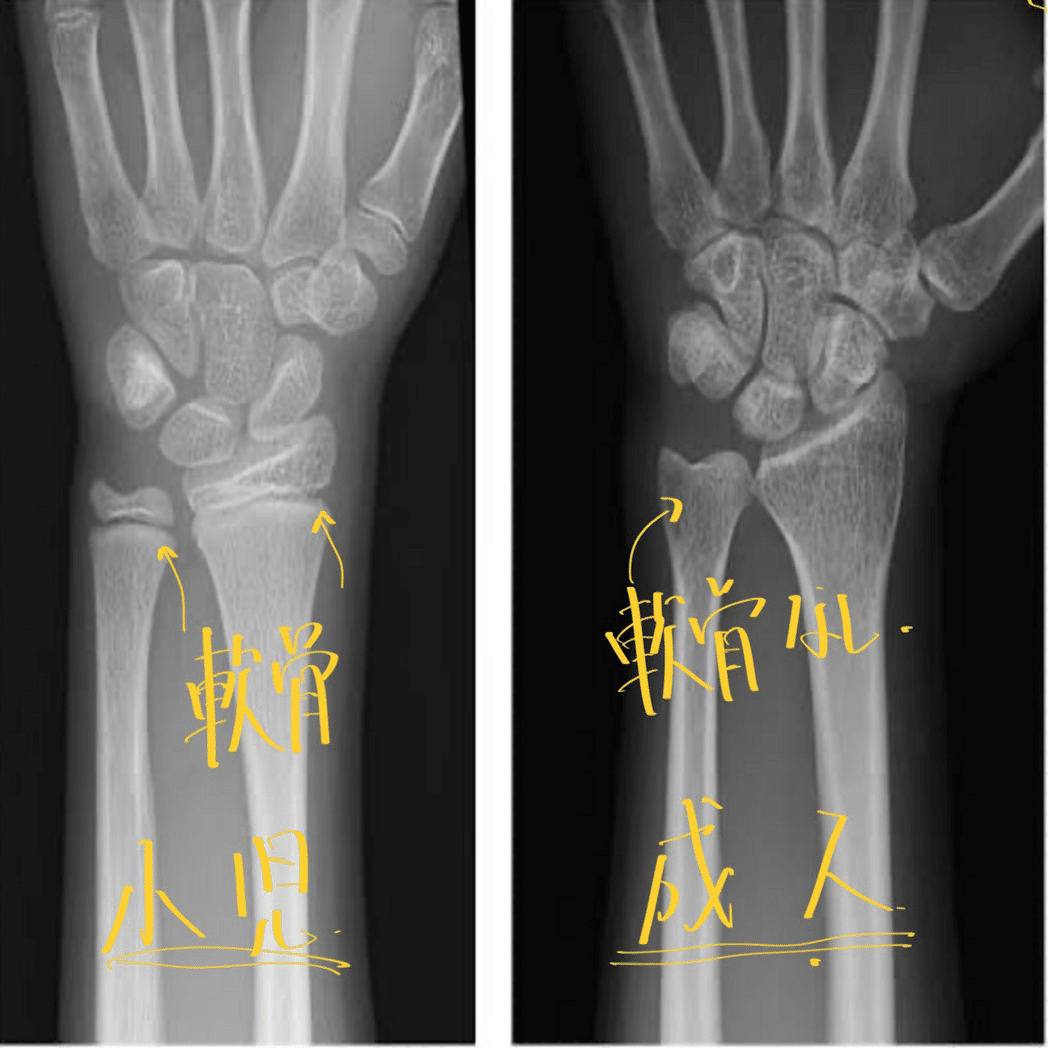 第59回理学療法士国家試験AM4問目｜ネクストリハアカデミー