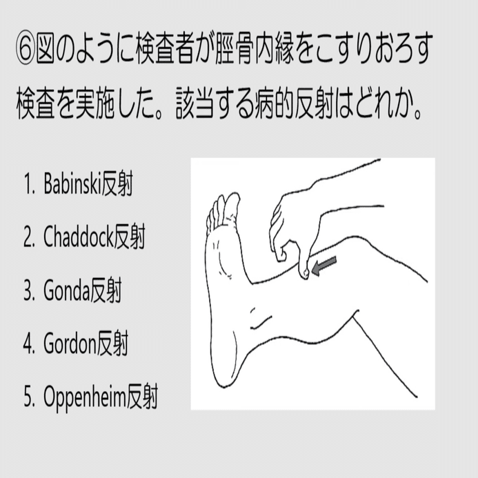 第59回理学療法士国家試験AM6問目｜ネクストリハアカデミー