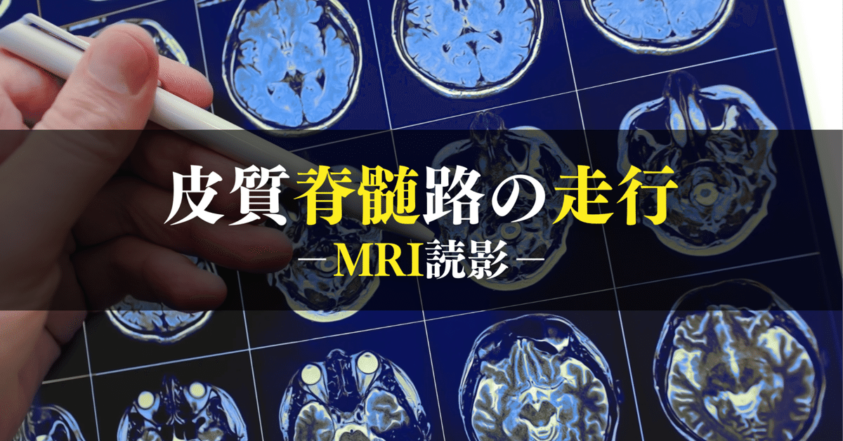 Nightmare 症候群　的野美青　生写真8コンプ 櫻坂46 的野美青 生写真 nightmare症候群 MV衣装 8種類コンプ