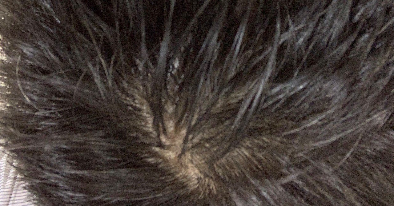 30年以上 つむじ の位置を間違えていた男 高井浩章 Note 30年以上 つむじ の位置を間違えていた男 高井浩章 Note