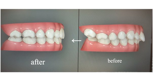 歯科矯正学実習 Web動画付/医歯薬出版株式会社