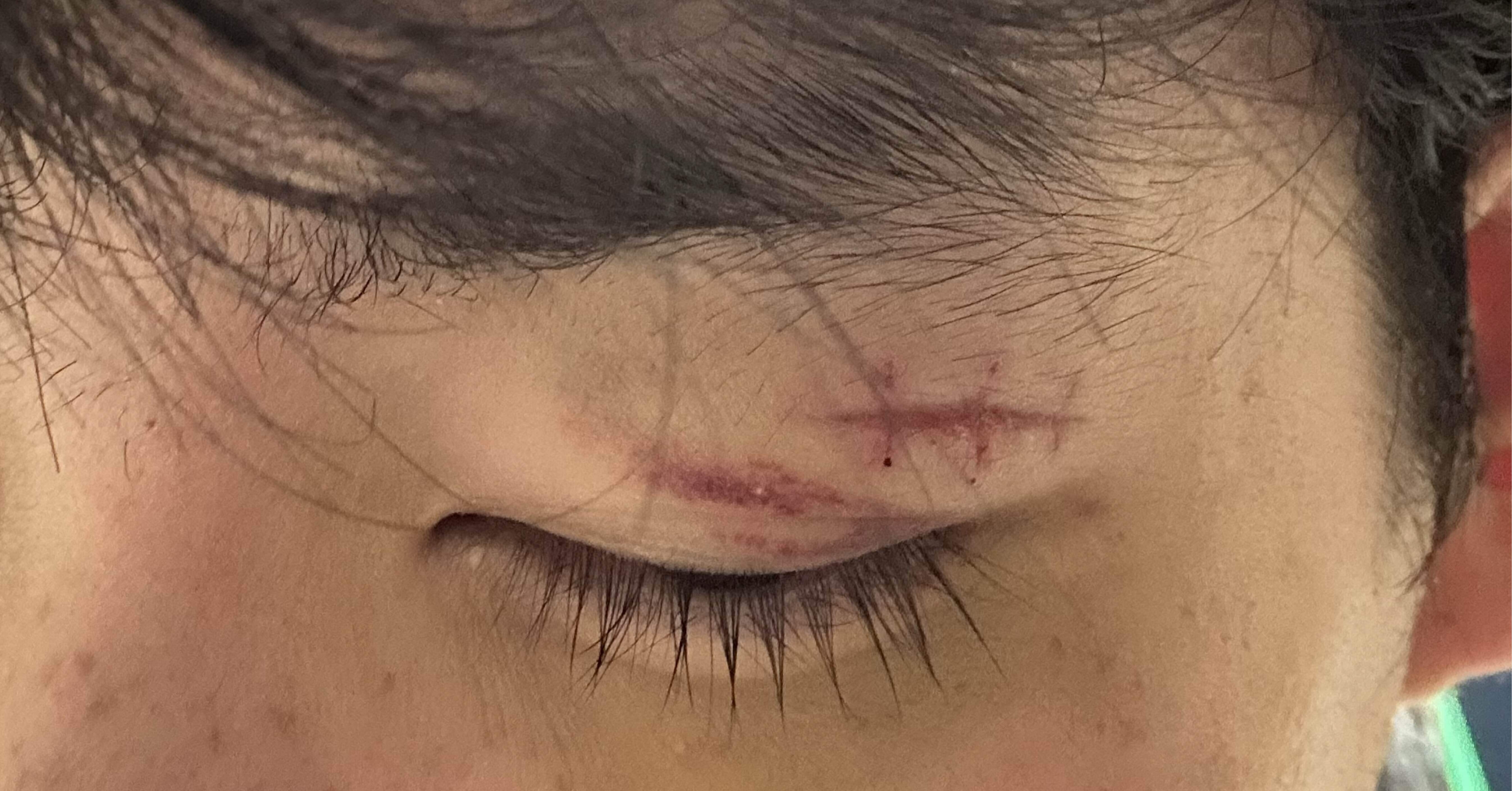至って目立つ傷はなし。裏に傷あり。 至って目立つ傷はなし。裏に傷あり。