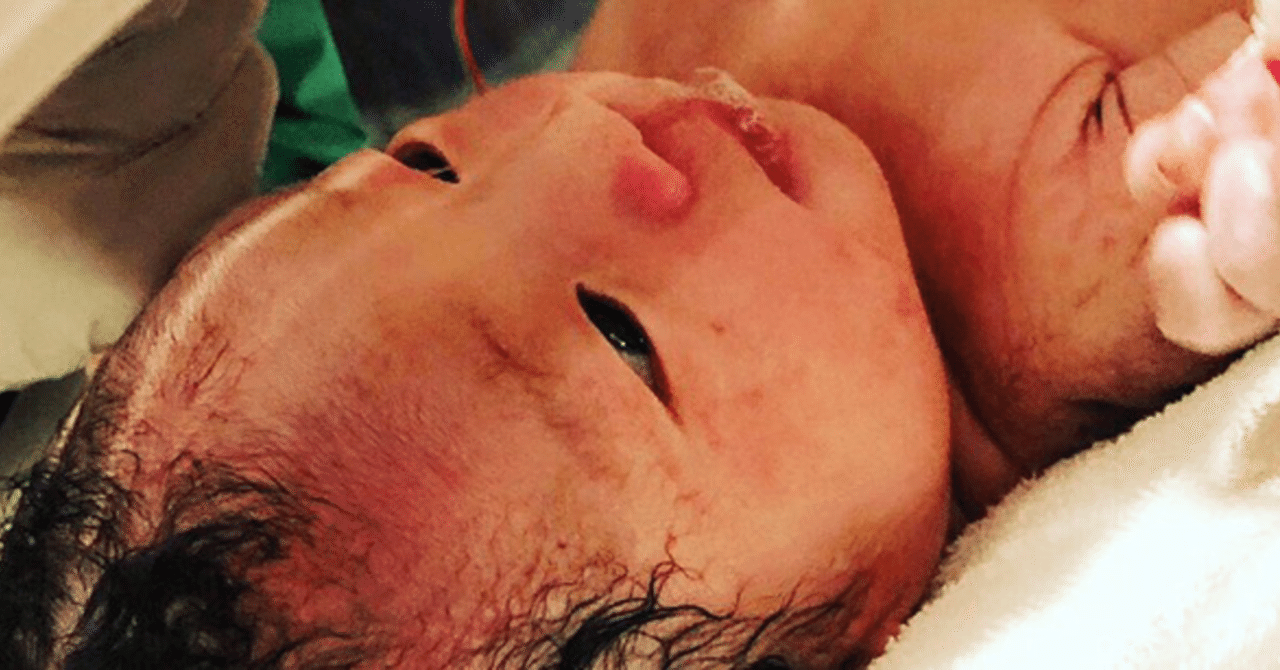 前編 66時間に及ぶ出産に立ち会った旦那は 母親になることの偉大さを知った 夫は絶対に出産の立ち会いをした方がいい Afroscript Note