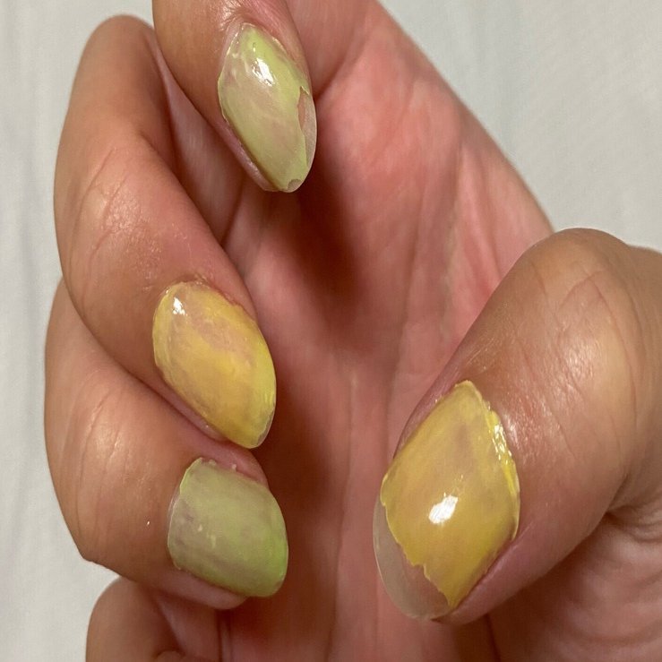 チョコザップネイルでひどい目に遭った件｜わたらせあやめ