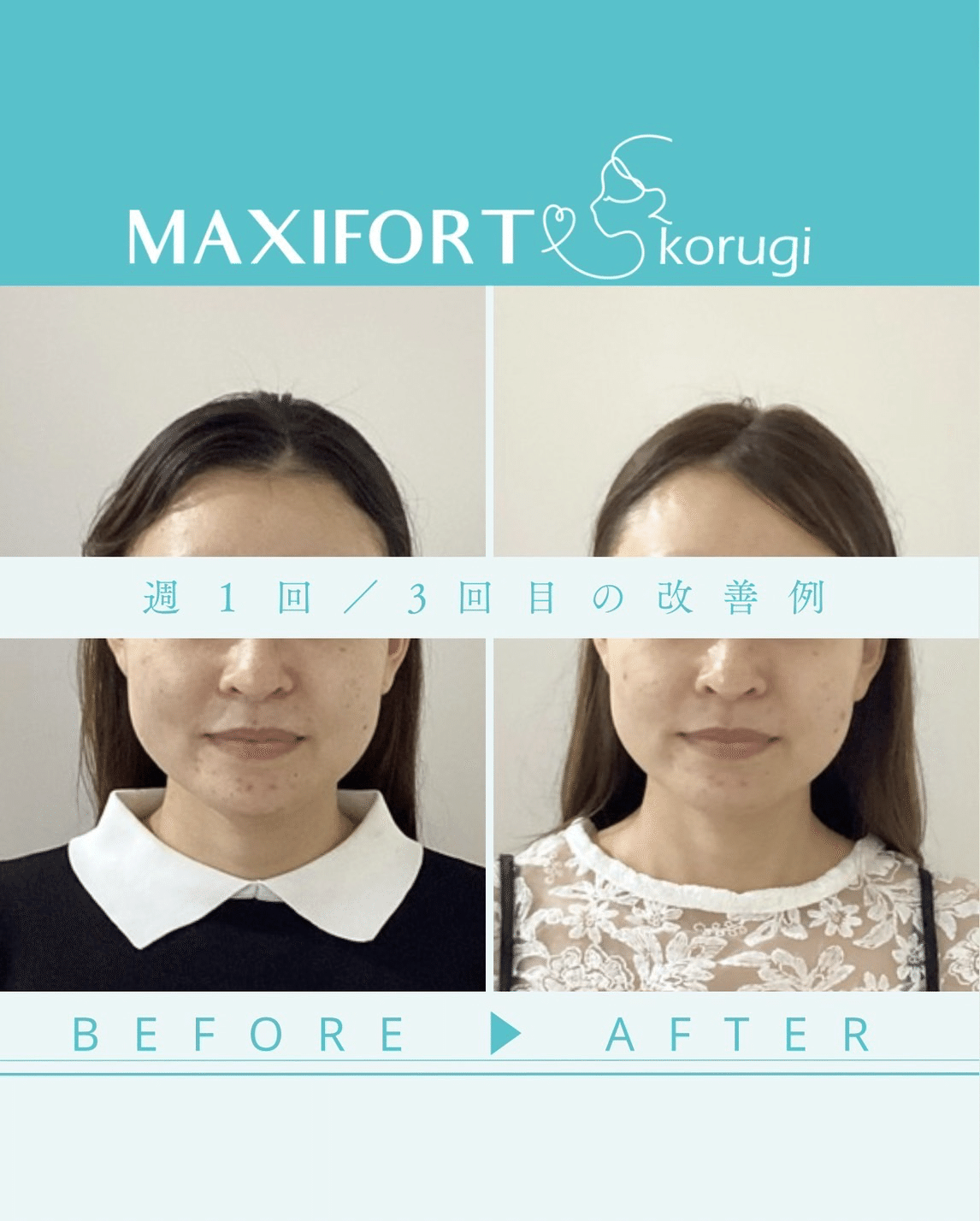 お顔の施術事例☆小顔コルギ☆途中経過をご紹介|小顔コルギ専門店マキシフォート<MAXIFORT>