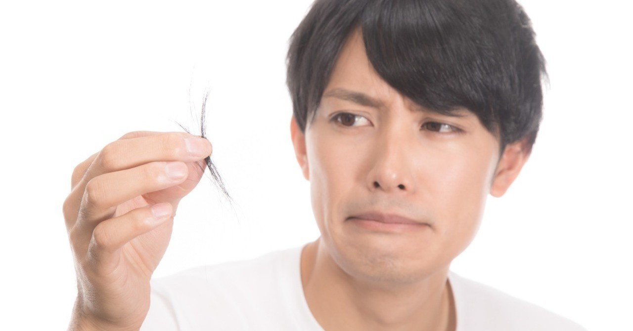 前髪の薄毛がシースルーバングを通り越して スダレハゲ になった時 どうする りょーすけ先生 髪ワザchannel Note