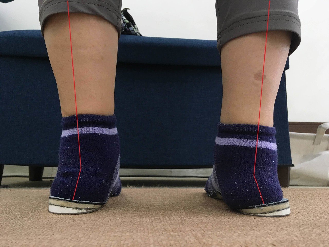 O脚の改善で絶対にやってはいけない事 こば Note O脚の改善で絶対にやってはいけない事 こば Note