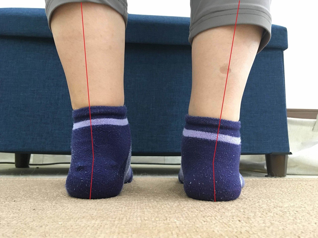 O脚の改善で絶対にやってはいけない事 こば Note O脚の改善で絶対にやってはいけない事 こば Note