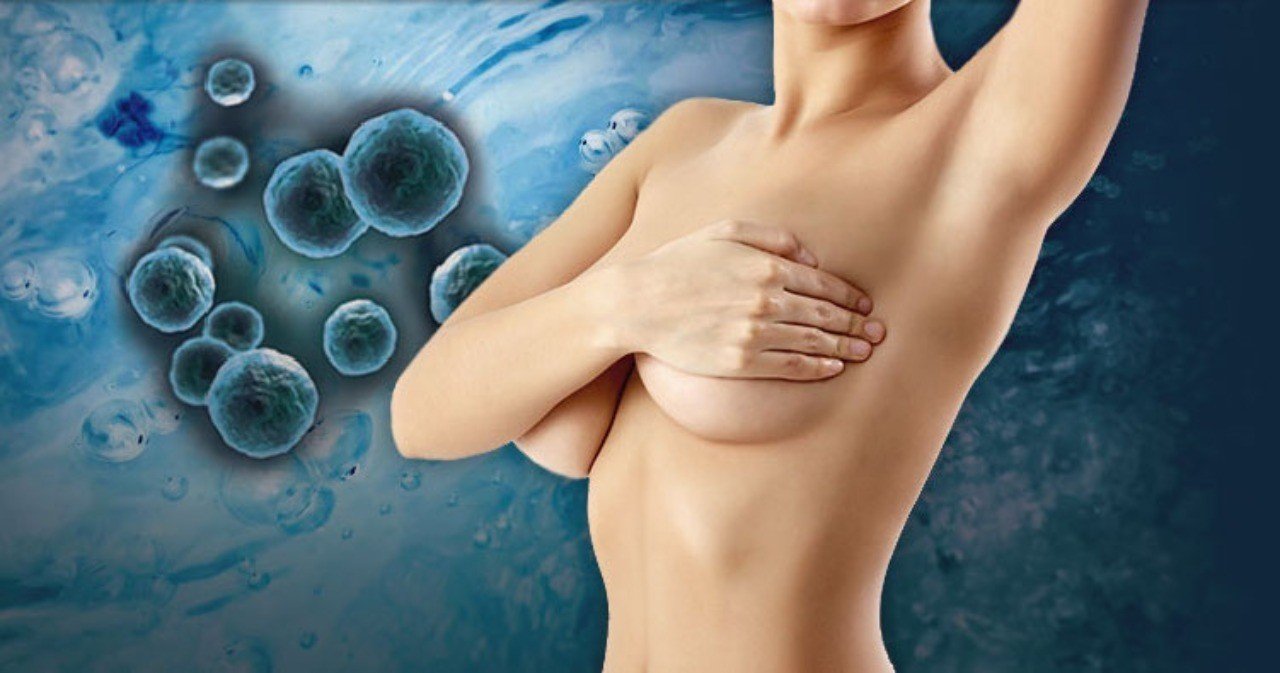 豊胸手術で失敗しないために知っておきたい5つの常識 ヒアルロン酸 アクアフィリング編 Tc Breast Beauty Note