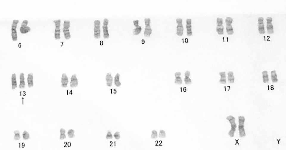 13トリソミーの次女と妊娠5ヶ月での中期中絶手術を経て 小鳥遊正璽 たかなしせーじ Note