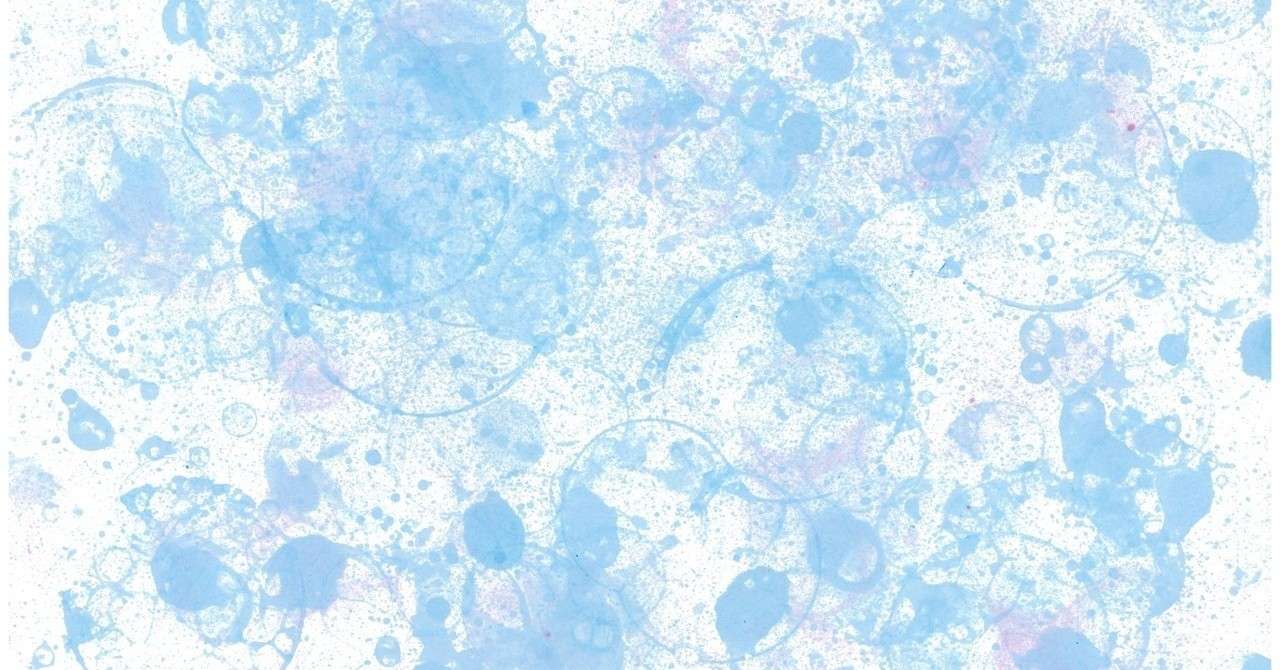 コンタクトレンズは ちょうど地球から見た満月くらいの大きさ 野々原蝶子 Note