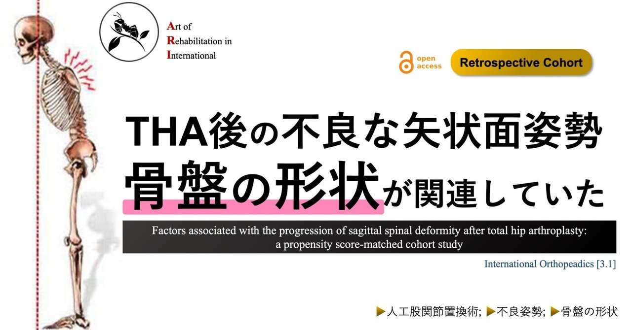 THA後の不良な矢状面姿勢。骨盤の形状が関連していた｜Super