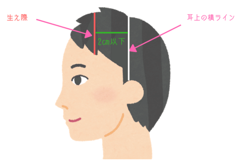 前髪ハゲ確認