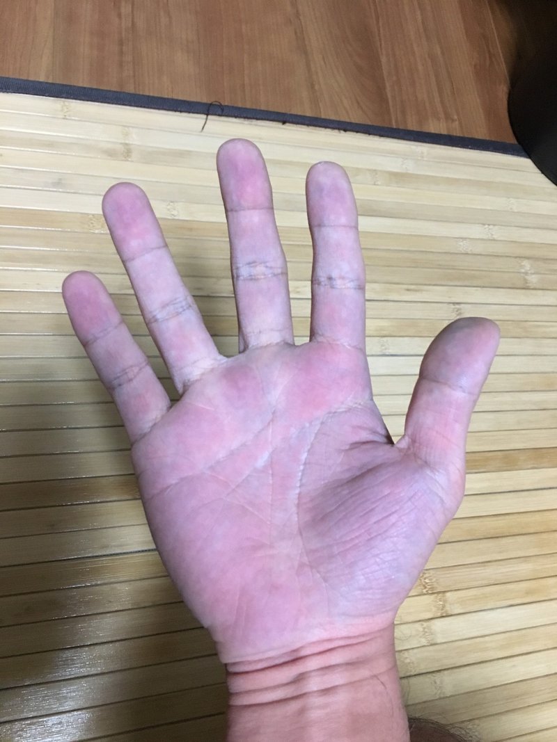 ナイアシンフラッシュを試してみた 芦野夕狩 Note ナイアシンフラッシュを試してみた 芦野夕狩 Note