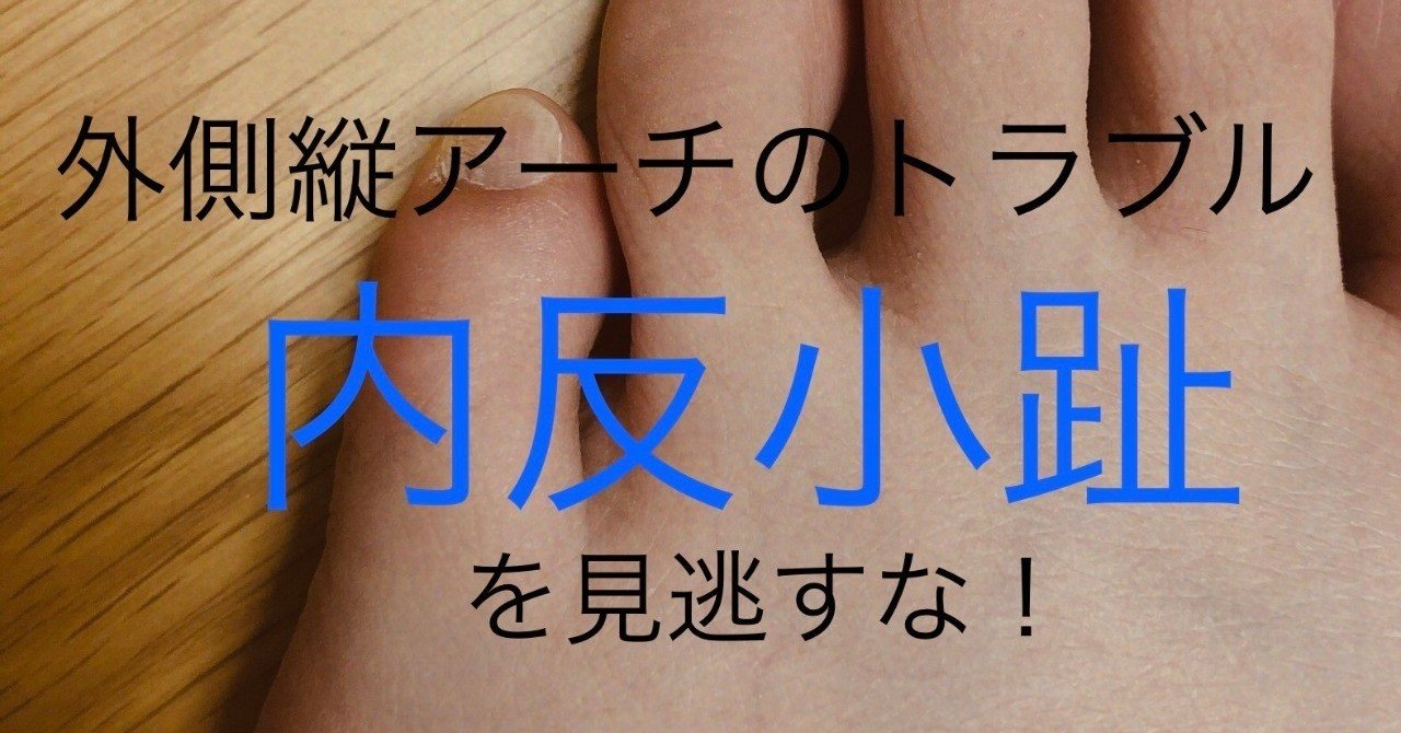 外側縦アーチのトラブル 内反小趾を見逃すな Ryoko M Note