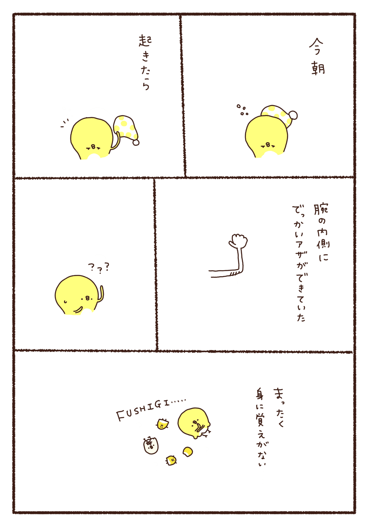 1日1絵日記チャレンジ 157 覚えのないアザって怖い やまだ あいこ Note 1日1絵日記チャレンジ 157 覚えのないアザって怖い やまだ あいこ Note