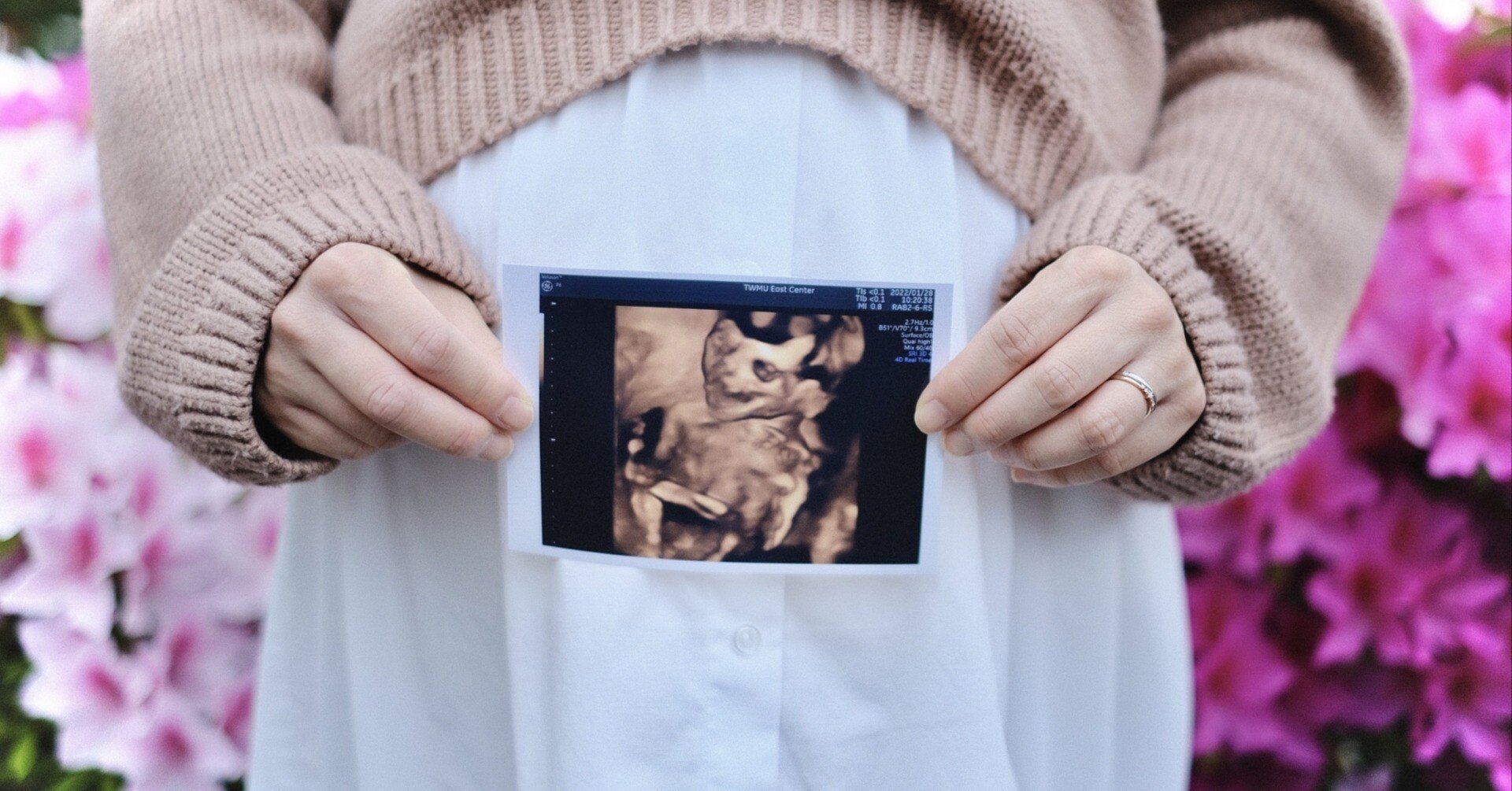 ここまで見える胎児心エコー検査｜☆近大小児科すくすくナビ〜こどもの