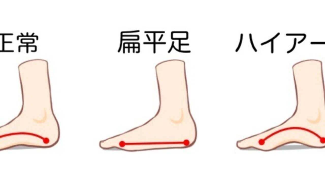 加齢に伴う足部の変化｜ウォーキング療法士