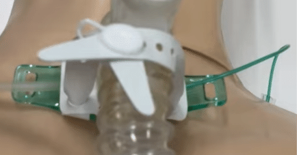 レスピセーフバンド」使用レビュー｜かわうそ