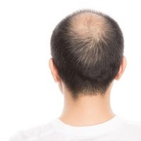 ヘルメットや帽子でハゲる 薄毛の噂はウソ 本当 りょーすけ先生 髪ワザchannel Note