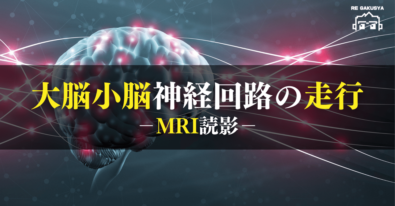 ○脳神経検査のグノーティ・セアウトン : この検査では,ここが見えない part 脳神経検査のグノーティ・セアウトン : この検査では,ここが見え