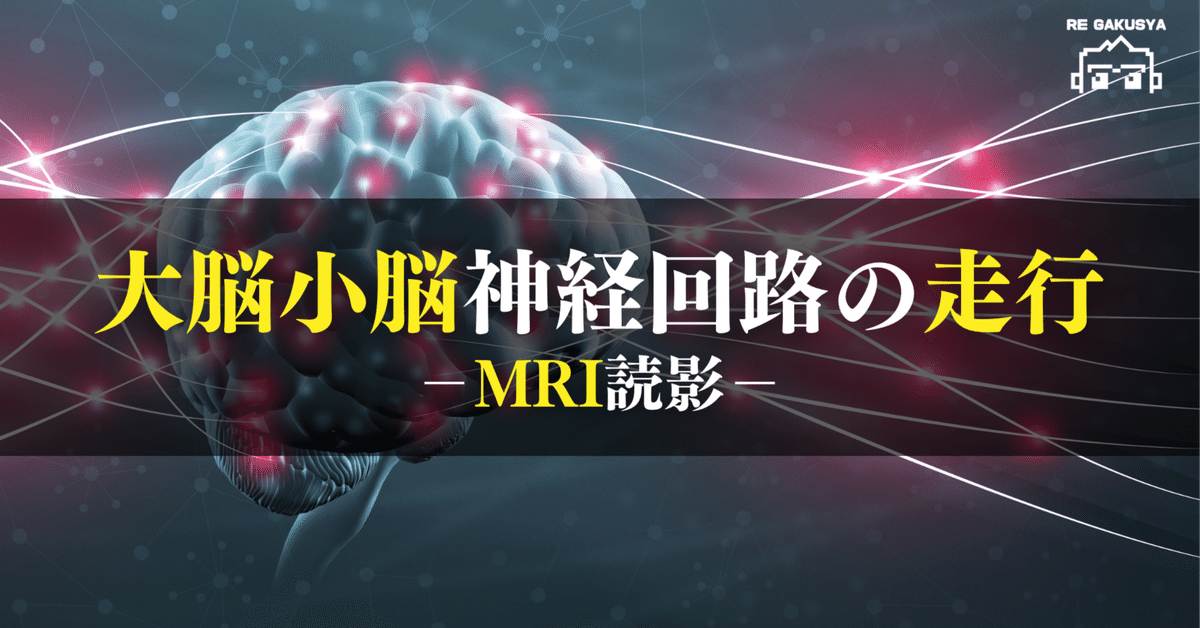 ○脳神経検査のグノーティ・セアウトン : この検査では,ここが見えない part ○脳神経検査のグノーティ・セアウトン : この検査では,ここが