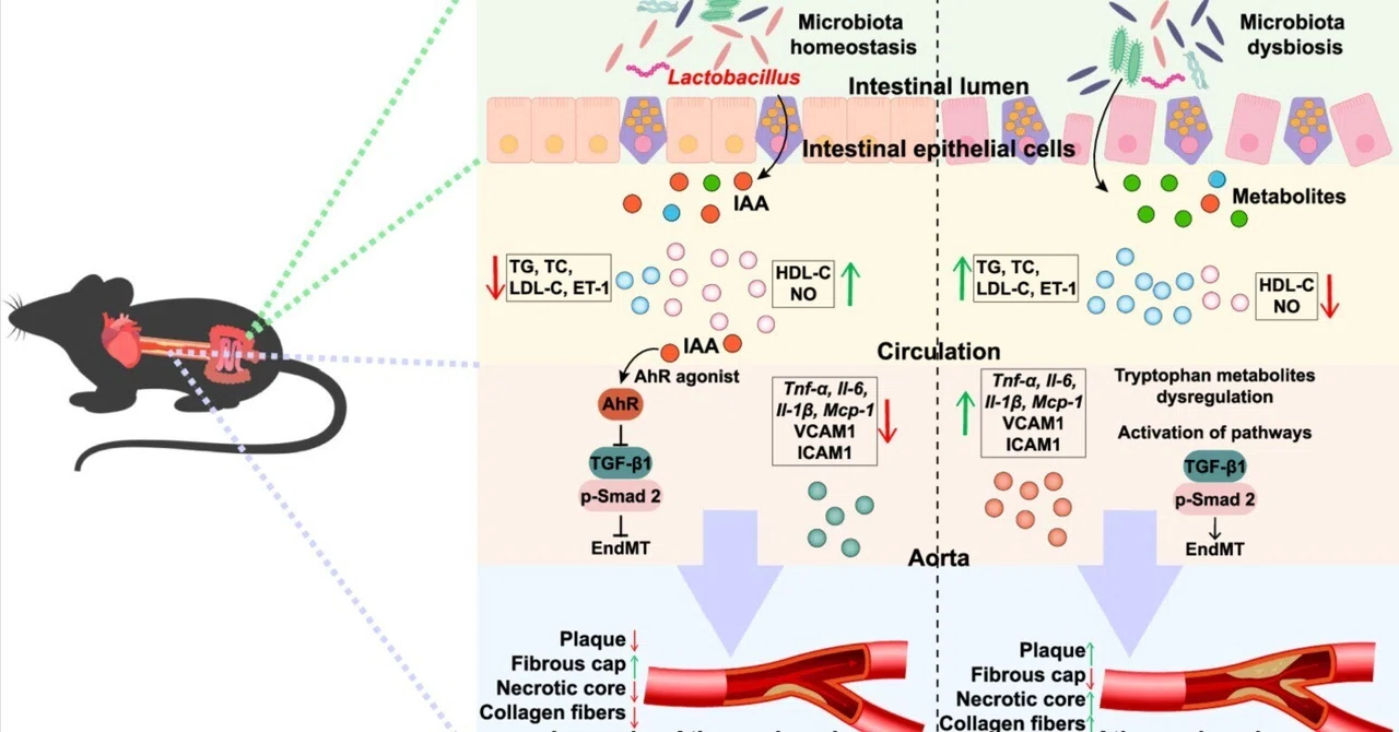Aucubin ameliorates atherosclerosis by regulating tryptophan metabolism ...
