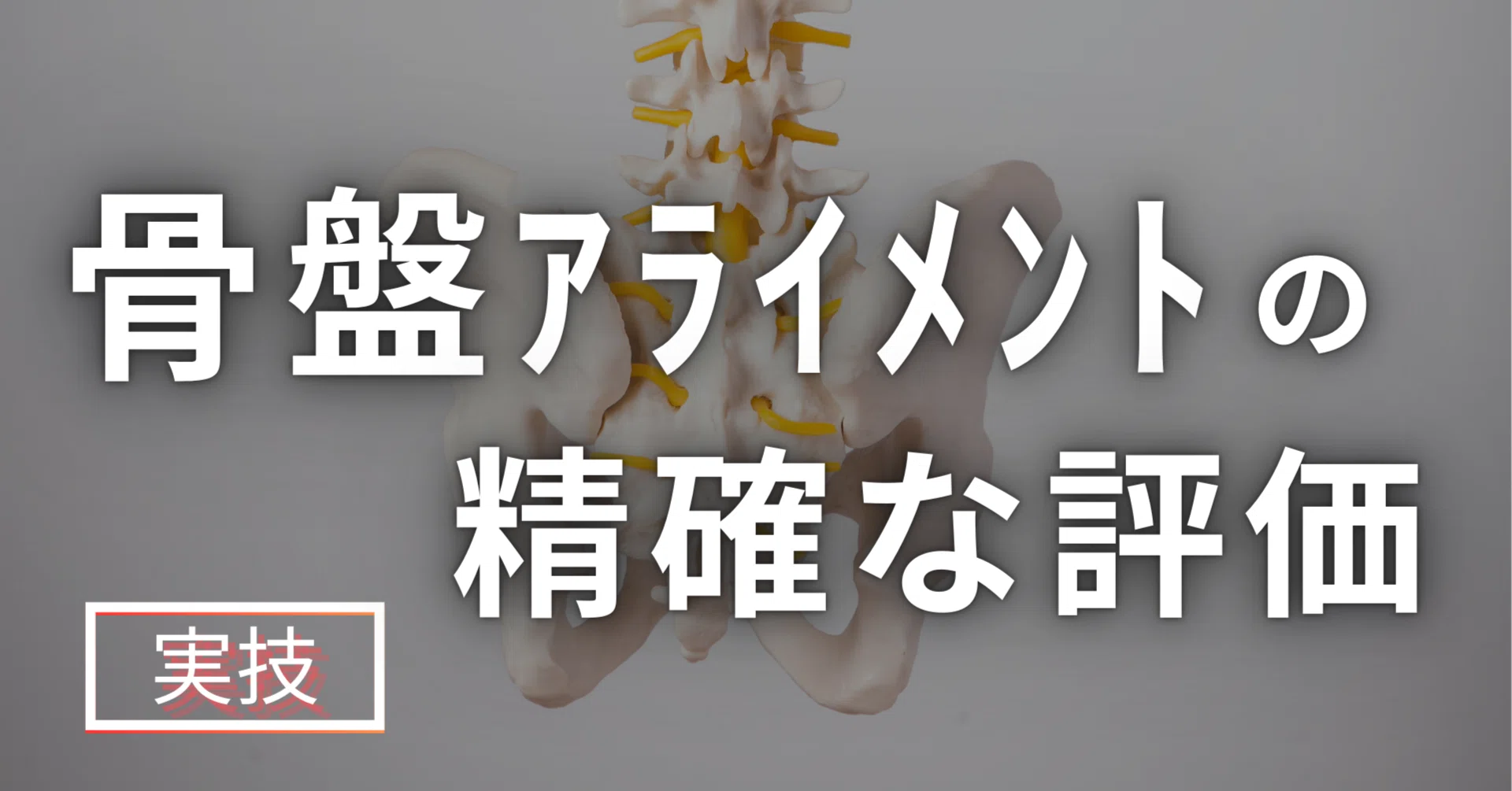 骨盤アライメントの精確な評価｜理学療法士による臨床のためのnote