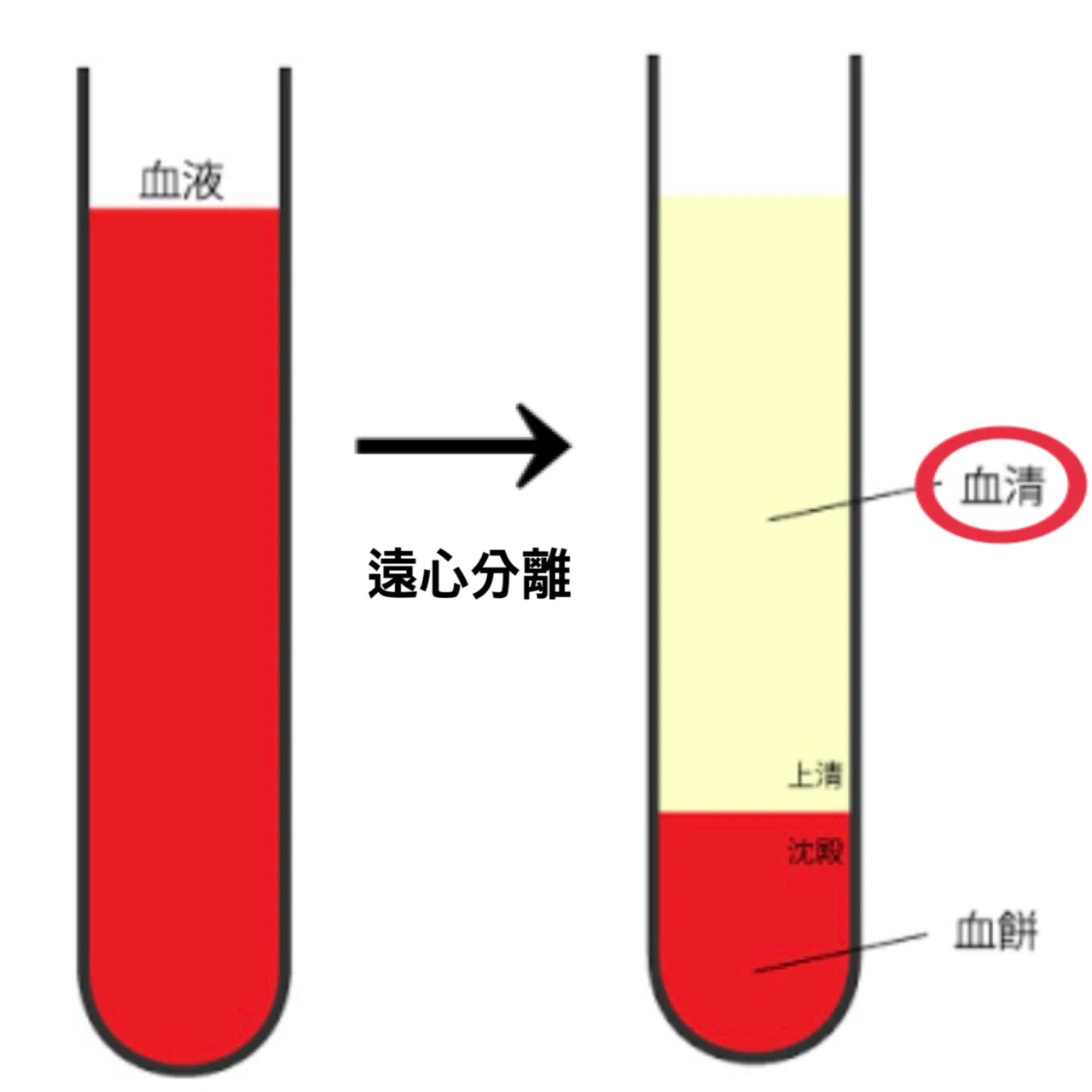 生 化学 検査