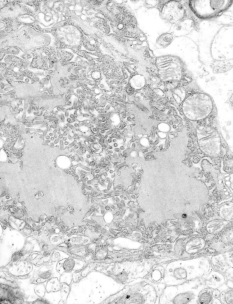 パスツールと予防接種 ～多くの命を救った近代微生物学の父～｜Gelate
